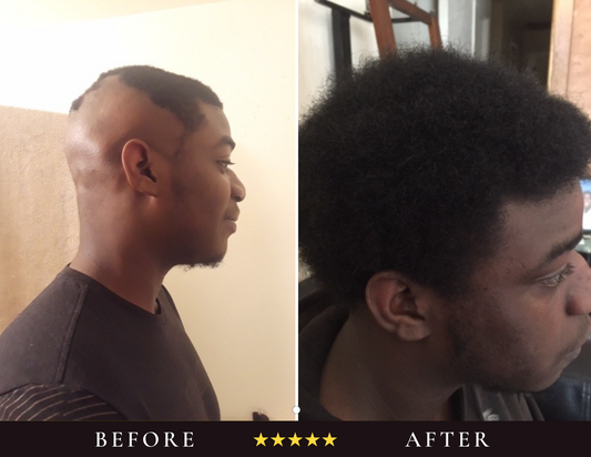 The Scalp System
